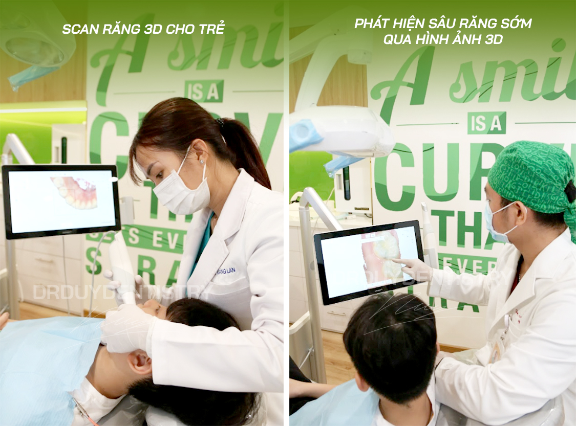 hàm trainer cho trẻ em dr duy dentistry