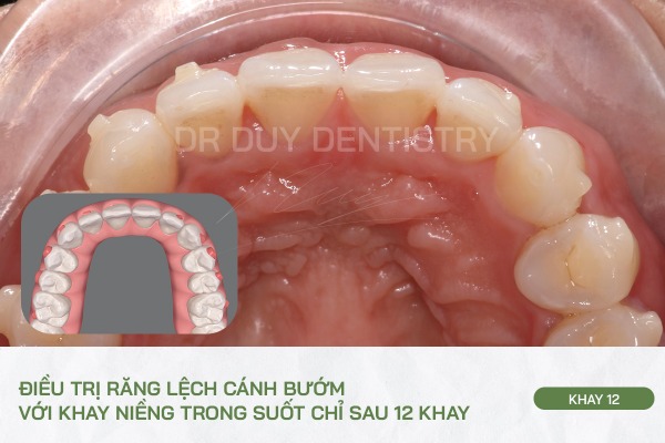 Dr Duy Dentistry